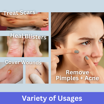 Hydrocolloid Treatment